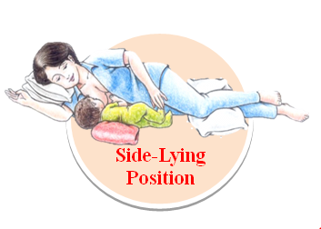 Side-lying position