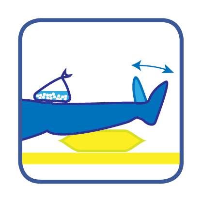 Elevate your affected limb and frequently perform ankle pump exercise to help reduce joint/limb swelling.
						Ice therapy is recommended to improve pain & swelling. (For 15-20 minutes each, every 2-3 hours a day.)