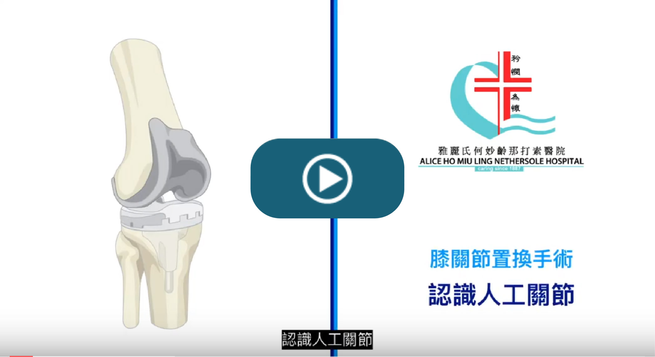 Understanding Knee Replacement