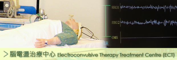 Electroconvulsive Therapy Treatment Centre