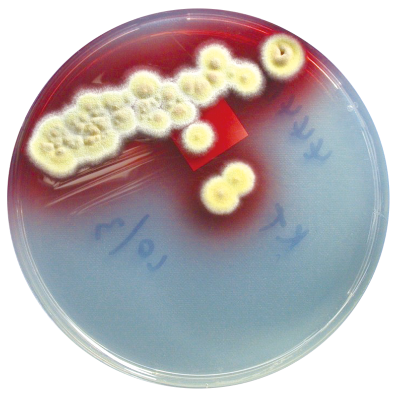 Petri dishes of different colours are filled with specific ingredients which facilitate bacteria culturing.