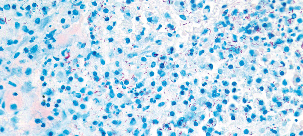 Cells and tissue: Tell malignancy from 20-minute test