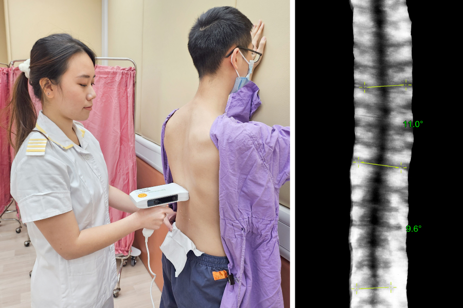 Rachel (left) believes that Scolioscan can help monitor the effectiveness of physiotherapy.
