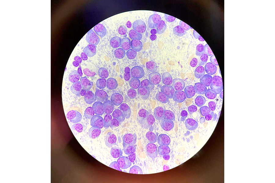 Bone marrow under a microscope.