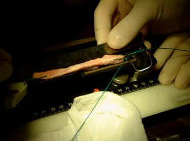 Department of Orthopaedics & Traumatology 14