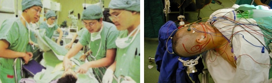 Preparing for the Auditory Brainstem Implant operation