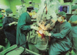 Auditory Brainstem Implant in progress under operating microscope